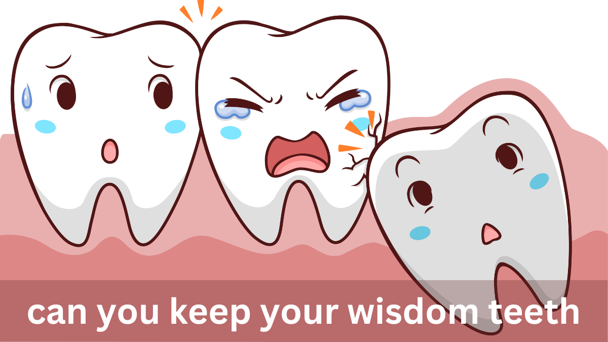 Surprising Truth: Can You Keep Your Wisdom Teeth?