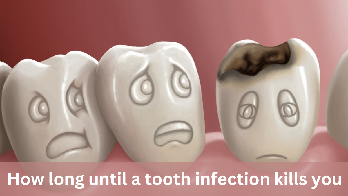 how long until a tooth infection kills you