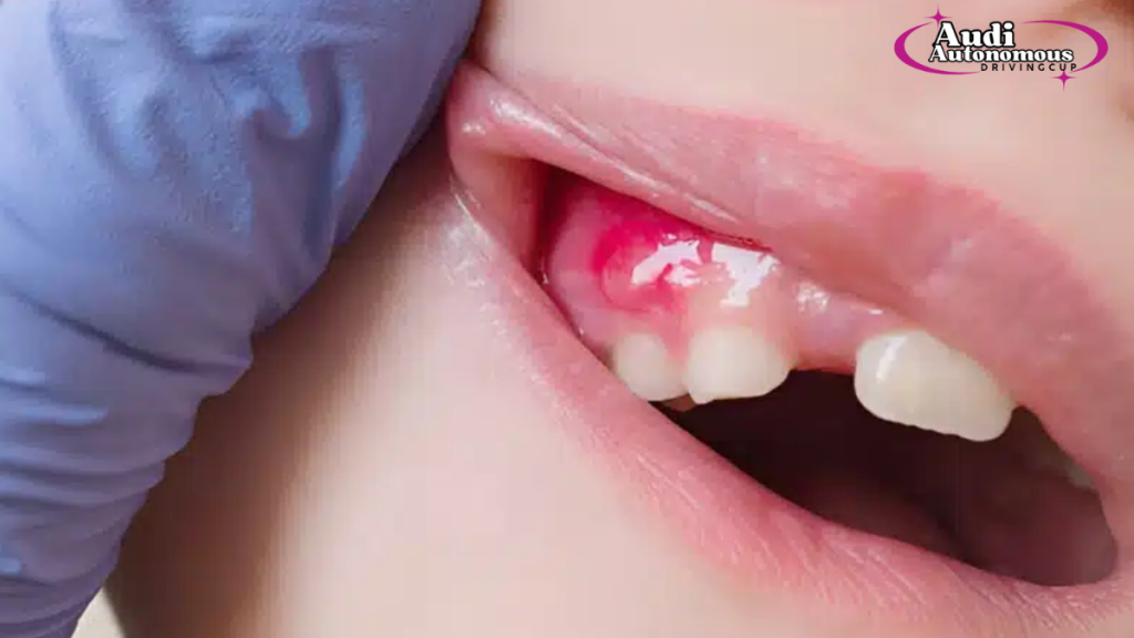 how long until a tooth infection kills you