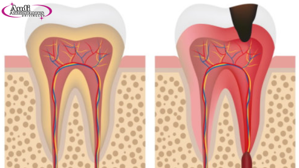 how long until a tooth infection kills you